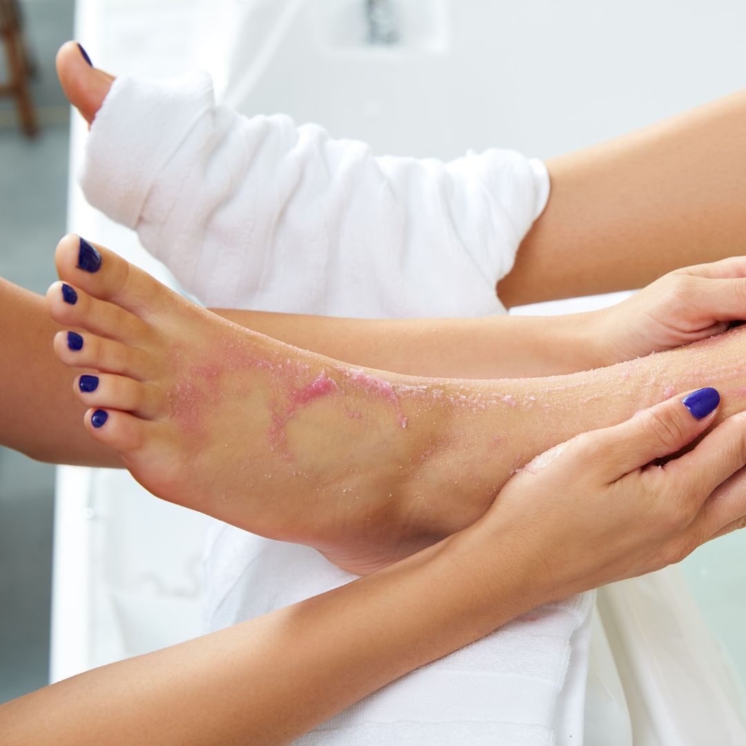 Soin des pieds image